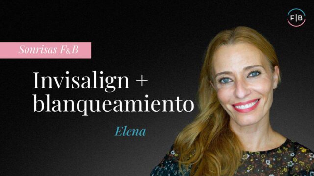 La sonrisa de Elena
