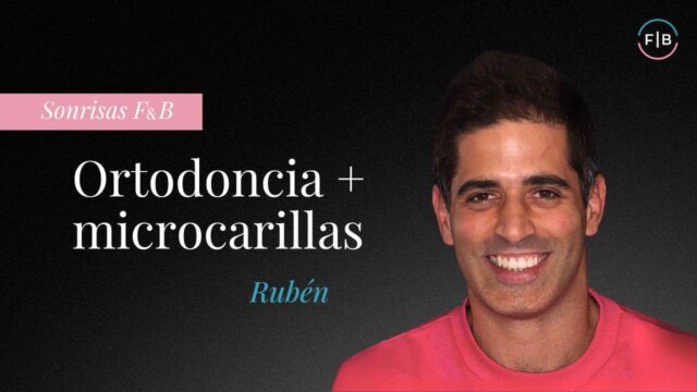 La sonrisa de Rubén