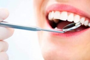 Manchas en el esmalte de los dientes