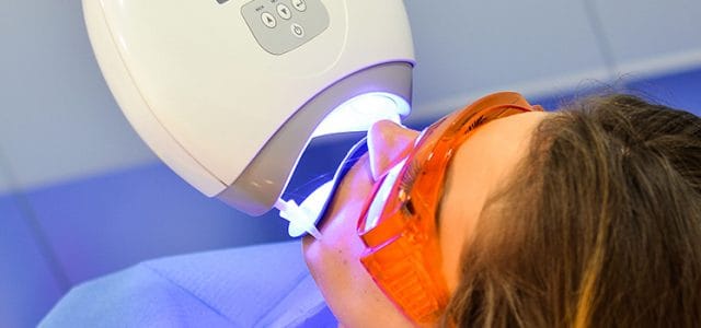 Blanqueamiento dental combinado Como blanquear el esmalte de tus dientes
