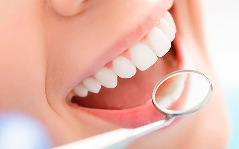 Cómo blanquearte los dientes en casa Remedios efectivos para blanquear los dientes en casa