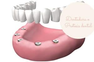 Dentadura dental movil