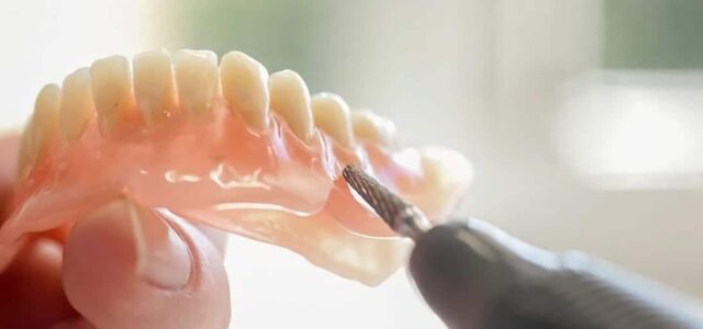 Tipos de dentadura postiza protesis-dental
