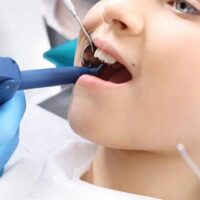 Ortodoncia removible para niños