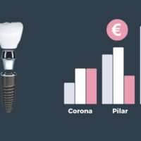 Estudio sobre los precios de los implantes dentales realizado por Ferrus & Bratos