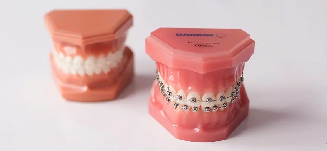 Precios de los Brackets 2024 Ferrus&Bratos