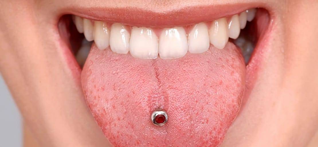 Piercing en la lengua: ¿qué contraindicaciones tiene? | Ferrus & Bratos