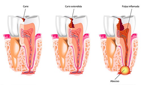 Beneficios de beber agua para la salud bucodental – Clínica DentalMEP