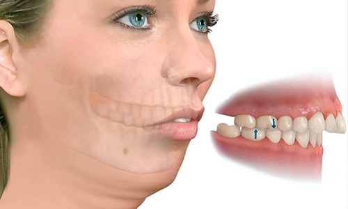 dolor en el frenillo debajo de la lengua