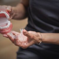 Conoce cómo se transforma tu sonrisa antes y después de ortodocnia invisible