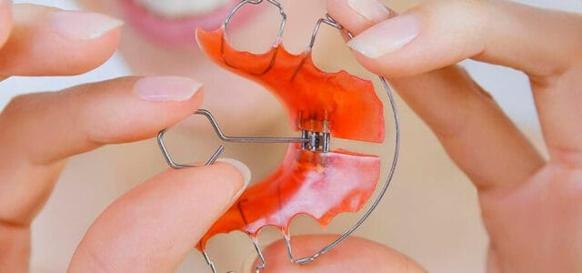 Ortodoncia para niños