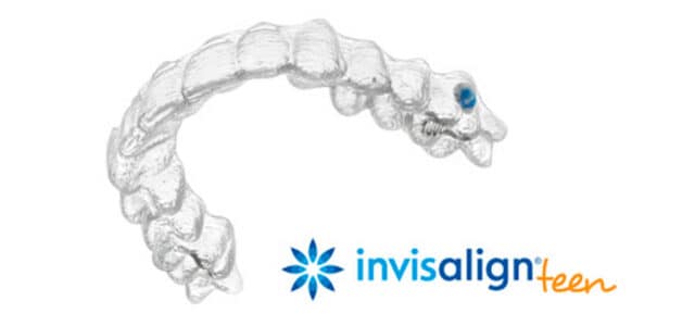 Invisalign Teen