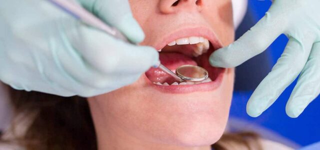 Apiñameinto dental tratamiento Apiñamiento dental