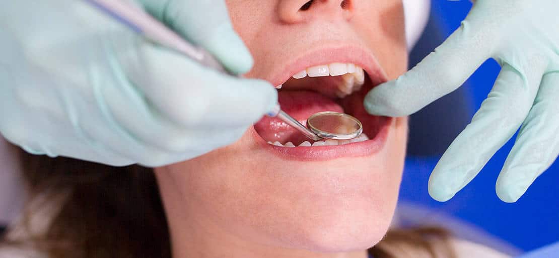 Apiñamiento dental: ¿cómo corregirlo? | Ferrus&Bratos