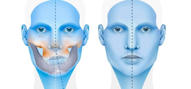 Asimetría facial tratamiento sin cirugía