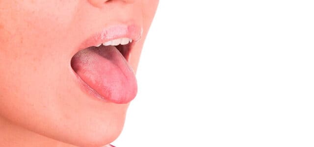El color natural de la lengua es rosado