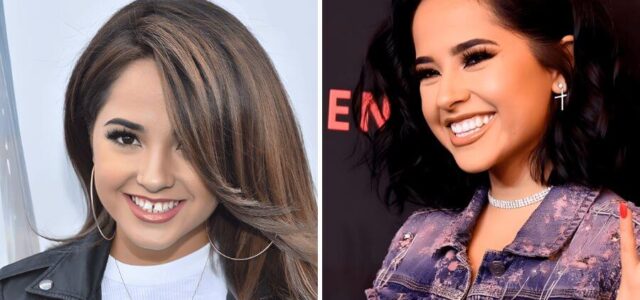 Becky G con carillas dentales