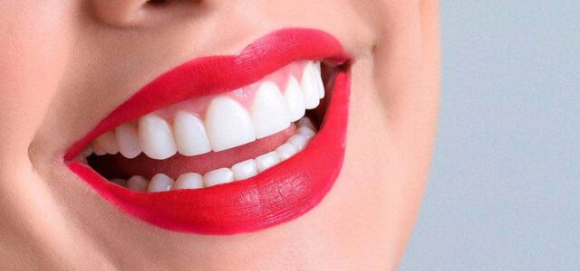 Blancorexia Obsesión por los dientes