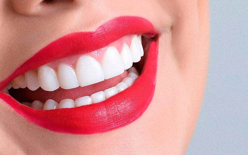 Blancorexia Obsesión por los dientes