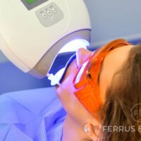 Blanqueamiento dental y embarazo