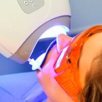 Blanqueamiento dental combinado