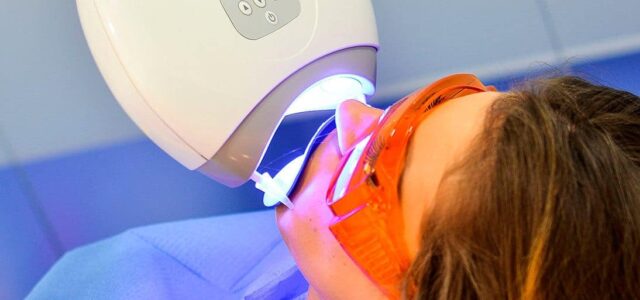 Blanqueamiento combinado Blanqueamiento dental combinado
