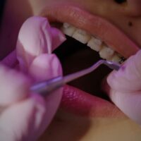 Los brackets estéticos, una opción muy demandada por los pacientes de la Clínica Dental Ferrus & Bratos