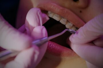 Los brackets estéticos, una opción muy demandada por los pacientes de la Clínica Dental Ferrus & Bratos