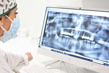 ¿Qué son los implantes de carga inmediata?