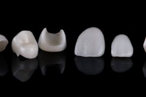 Carilla ceramica