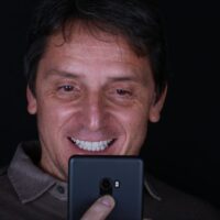 Conoce las desventajas de las carillas dentales