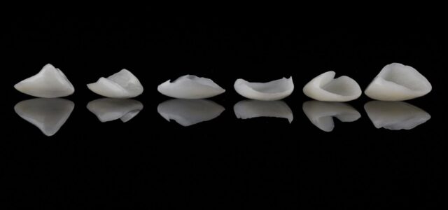 Finas laminas de carillas dentales de porcelana