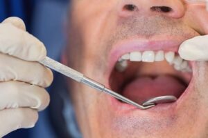 Cirugía periodontal para tratar periodontitis