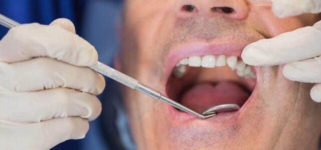 Cirugía periodontal para curar piorrea Cirugía periodontal para tratar periodontitis