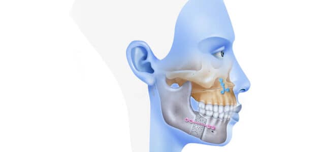 Cirugía maxilofacial recuperación