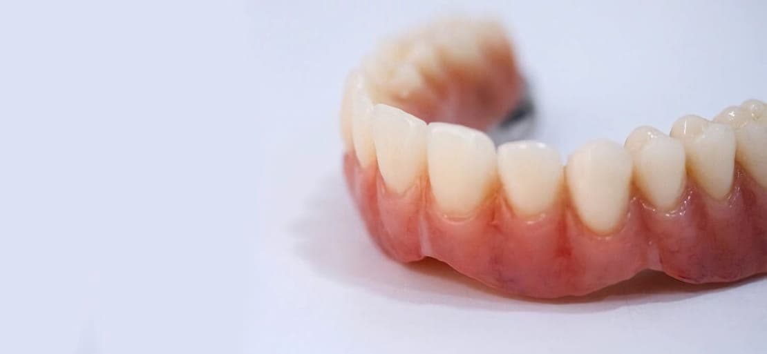 Cromático Estado tema Prótesis dental fija: todos los tipos que existen | Ferrus&Bratos