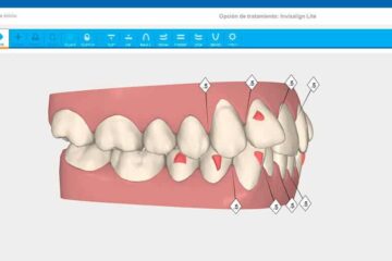 Software informático de Invisalign