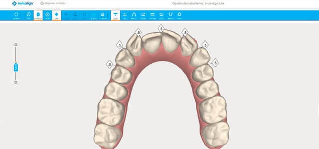 Planificación con Invisalign