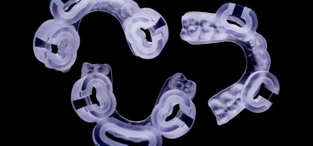 Guias inteligentes que facilitan el proceso de colocación de las carillas dentales