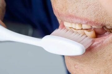 Causas y tratamiento del desgaste dental