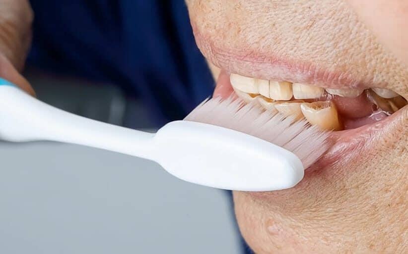 Causas y tratamiento del desgaste dental