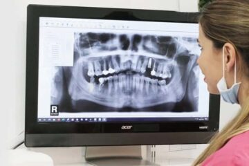 Cuidar implantes dentales