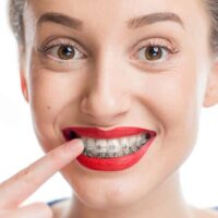 Cuidar ortodoncia