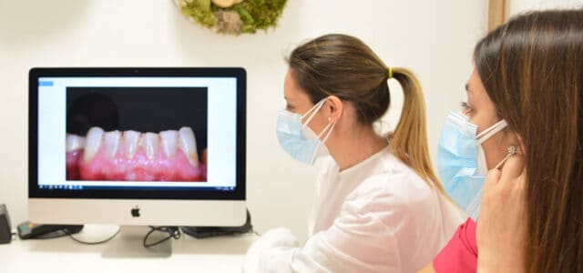 Encía con periodontitis