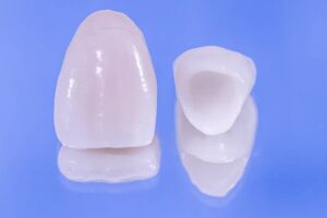 Prótesis dental provisional