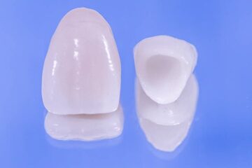 Prótesis dental provisional