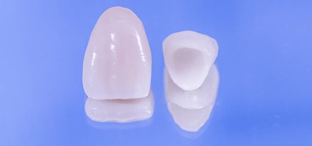 Prótesis dental provisional