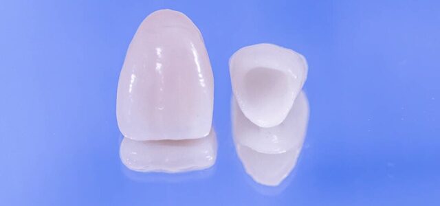 Corona provisional Prótesis dental provisional