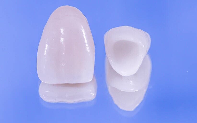 Corona provisional Prótesis dental provisional