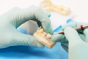 La incrustación restaura los dientes